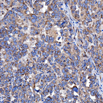 Anti-TTC7B Antibody