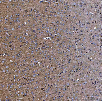 Anti-TTC7B Antibody