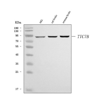 TTC7B Antibody