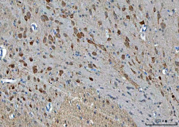 Anti-TSR2 Antibody