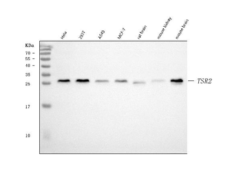 Anti-TSR2 Antibody