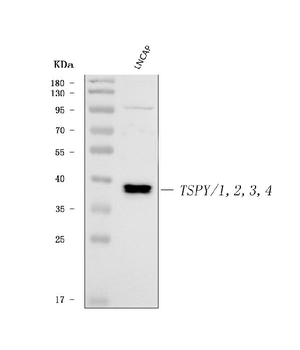 Anti-TSPY1/2/3/4 Antibody