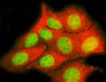 Anti-TRPS1 Antibody