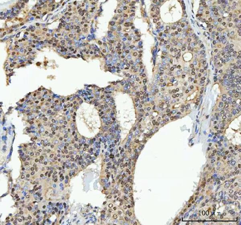 Anti-TRPS1 Antibody