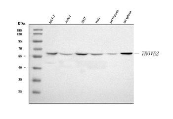 Anti-TROVE2/SS-A/RO60 Antibody