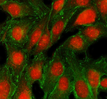 TRMT5 Antibody