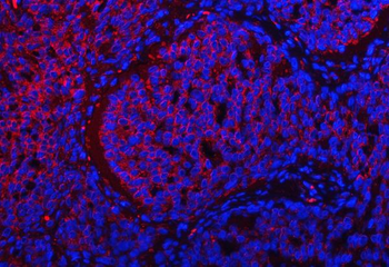 Anti-TRMT2B Antibody