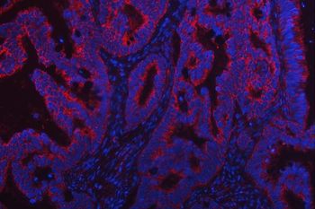 Anti-TRMT2B Antibody