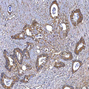 Anti-TRMT2B Antibody