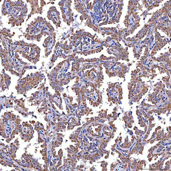 Anti-TRMT2B Antibody