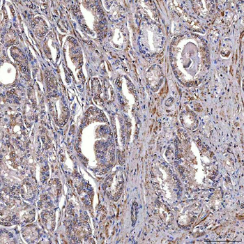 Anti-TRMT2B Antibody