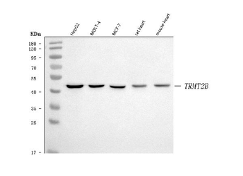 Anti-TRMT2B Antibody
