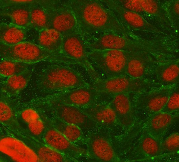 Anti-TRIM36 Antibody