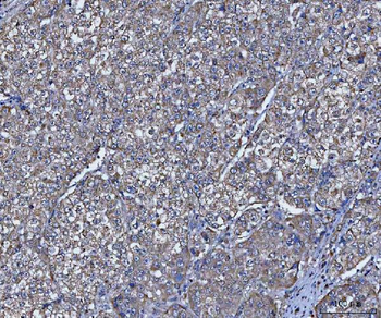 Anti-TRIM16 Antibody