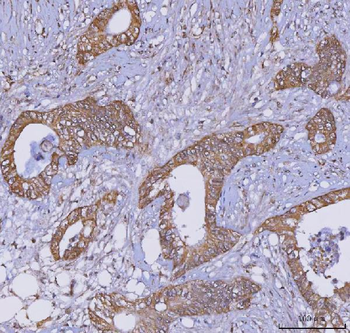 Anti-TRIM16 Antibody