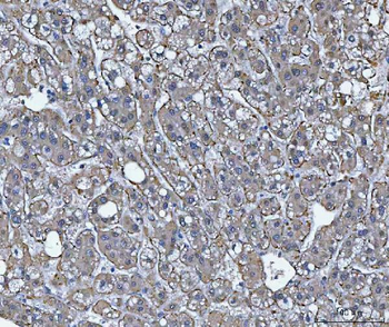Anti-TRIM16 Antibody