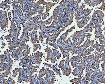 Anti-TRIM16 Antibody