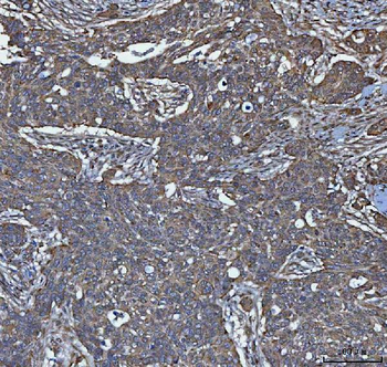 Anti-TRIM16 Antibody