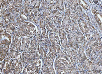 Anti-TRIM16 Antibody