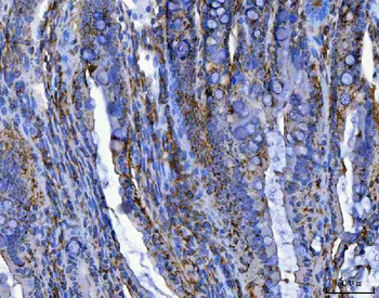 Anti-TRIM16 Antibody