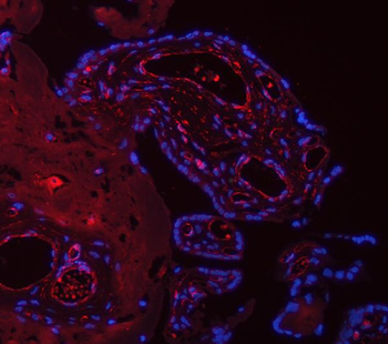 TP53I13 Antibody