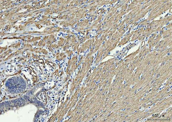 Anti-TP53I13 Antibody