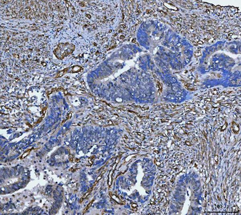 Anti-TP53I13 Antibody