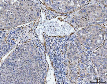 Anti-TP53I13 Antibody
