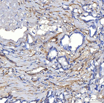 Anti-TP53I13 Antibody