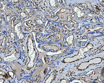 Anti-TP53I13 Antibody