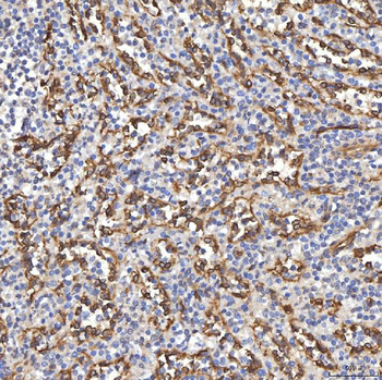 Anti-TP53I13 Antibody
