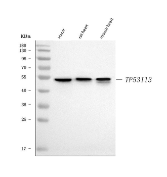 Anti-TP53I13 Antibody
