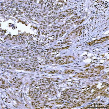 Anti-TOP3B Antibody