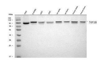 Anti-TOP3B Antibody
