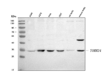 Anti-TOMM34 Antibody