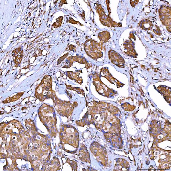 Anti-TOMM34 Antibody