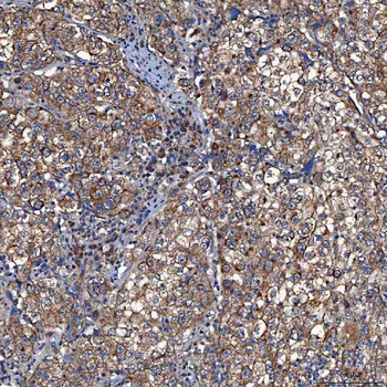 Anti-TOMM34 Antibody