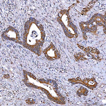 Anti-TOMM34 Antibody