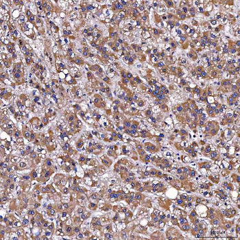 Anti-TOMM34 Antibody