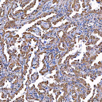 Anti-TOMM34 Antibody