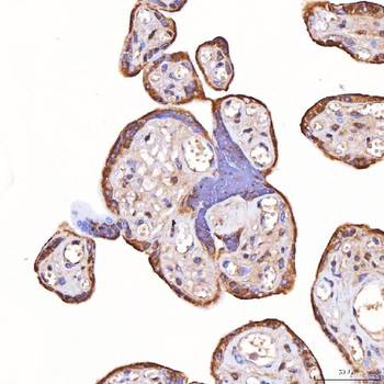 Anti-TOMM34 Antibody
