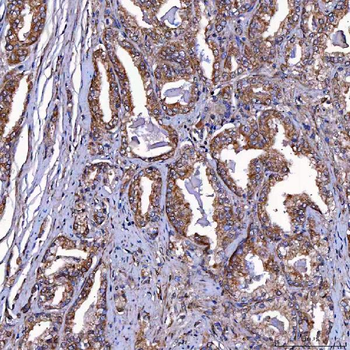 Anti-TOMM34 Antibody