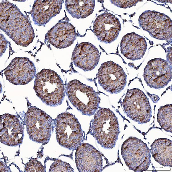 Anti-TOMM34 Antibody