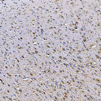 Anti-TOM1L1 Antibody