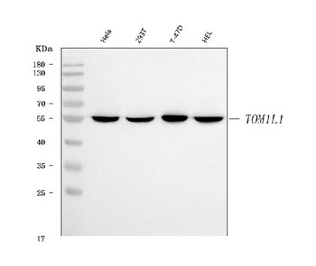 Anti-TOM1L1 Antibody