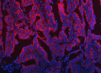 Anti-TOM1L1 Antibody