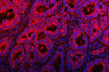 Anti-TOM1L1 Antibody