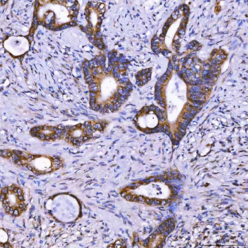 Anti-TOM1L1 Antibody