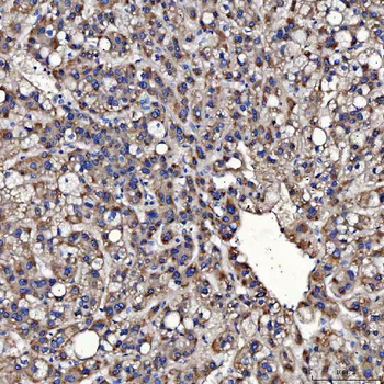 Anti-TOM1L1 Antibody