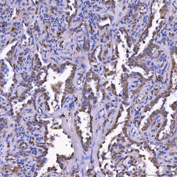 Anti-TOM1L1 Antibody
